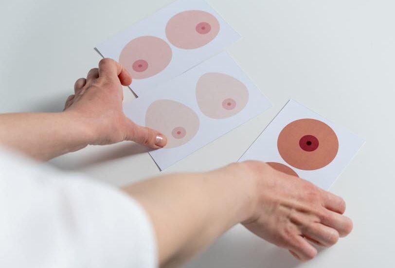 Love and Health: The Evolution of MrBeast’s Legacy (Part 3)Image of hands arranging breast anatomy illustrations for awareness and education.